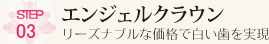 ＳＴＥＰ03　エンジェルクラウン　リーズナブルな価格で白い歯を実現